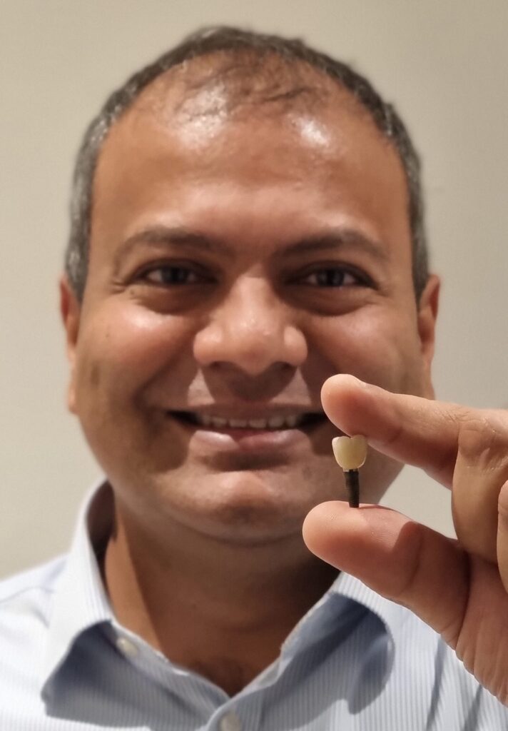 Dentist smiling and holding a dental implant tooth for camera.