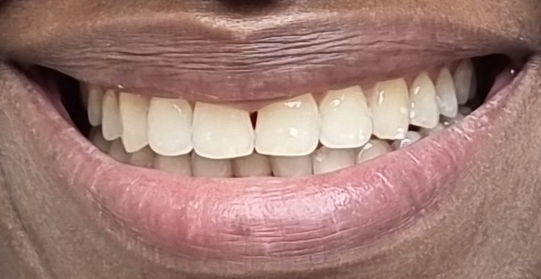 S DOWUONA AFTER SMILE