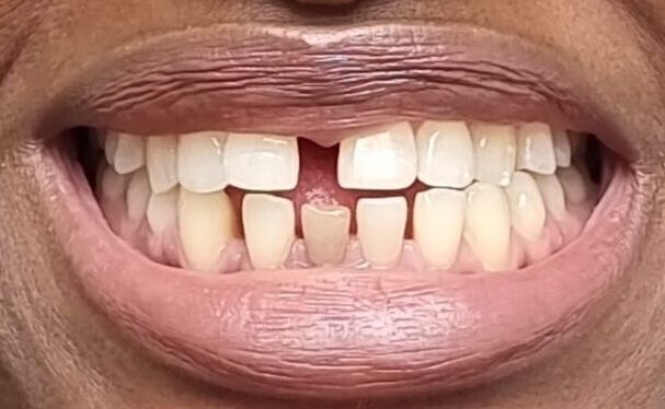 S DOWUONA BEFORE SMILE